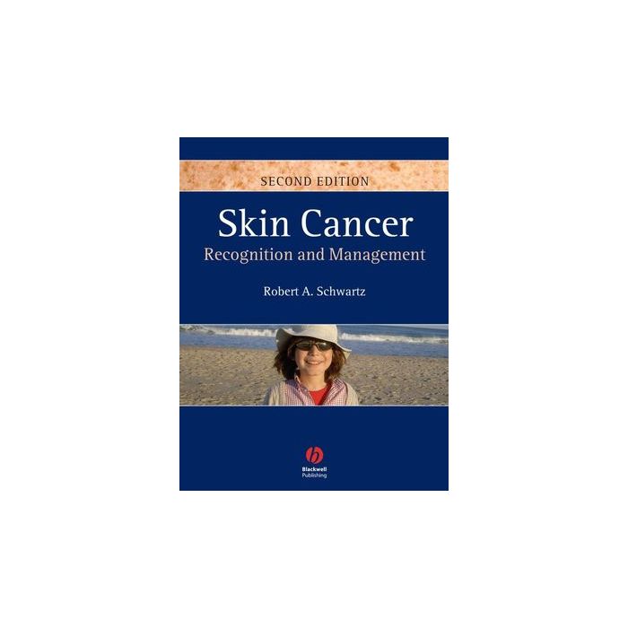 Skin Cancer: Recognition and Management, 2ed.  Schwartz Robert A.  Wiley - Blackwell  9781405159616