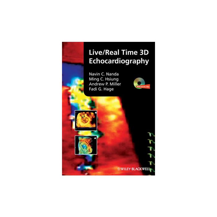 Live/Real Time 3D Echocardiography Nanda Navin; Hsiung Ming Chon; Miller Andrew P.; Hage Fadi G. Wiley - Blackwell 9781405161411 Live/Real Time 3D Echocardiography Nanda Navin; Hsiung Ming Chon; Miller Andrew P.; Hage Fadi G. Wiley - Blackwell 9781405161411