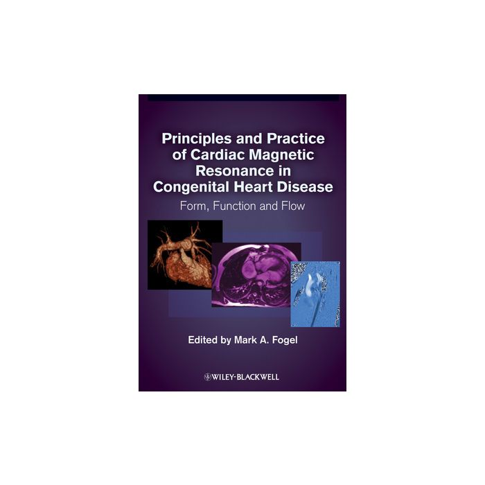 Principles and Practice of Cardiac Magnetic Resonance in Congenital Heart Disease: Form, Function and Flow  Fogel Mark A.  Wiley - Blackwell  9781405162364 Principles and Practice of Cardiac Magnetic Resonance in Congenital Heart Disease: Form, Function and Flow  Fogel Mark A.  Wiley - Blackwell  9781405162364