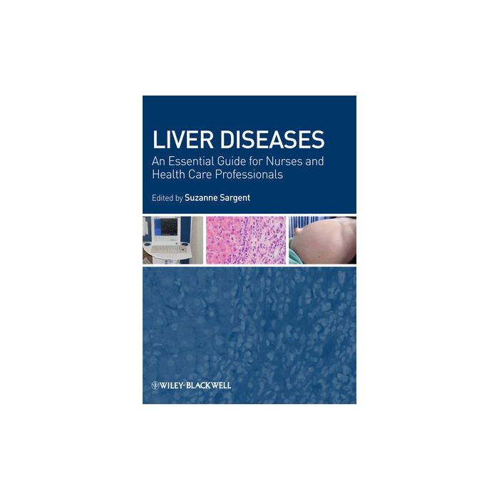 Liver Diseases: An Essential Guide for Nurses and Health Care Professionals  Sargent Suzanne  Wiley - Blackwell  9781405163064