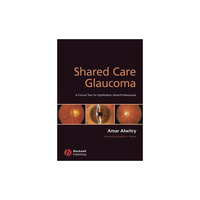 Shared Care Glaucoma  Alwitry Amar; Vernon Stephen  Wiley - Blackwell  9781405168007