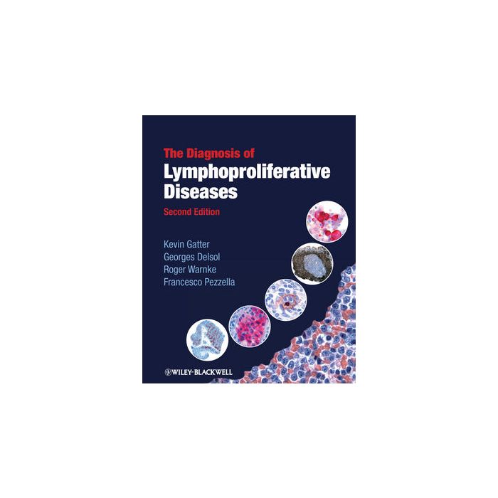 The Diagnosis of Lymphoproliferative Diseases, 2ed. Gatter Kevin; Delsol Georges; Warnke Roger; Pezzella Francesco Wiley - Blackwell 9781405170147 The Diagnosis of Lymphoproliferative Diseases, 2ed. Gatter Kevin; Delsol Georges; Warnke Roger; Pezzella Francesco Wiley - Blackwell 9781405170147