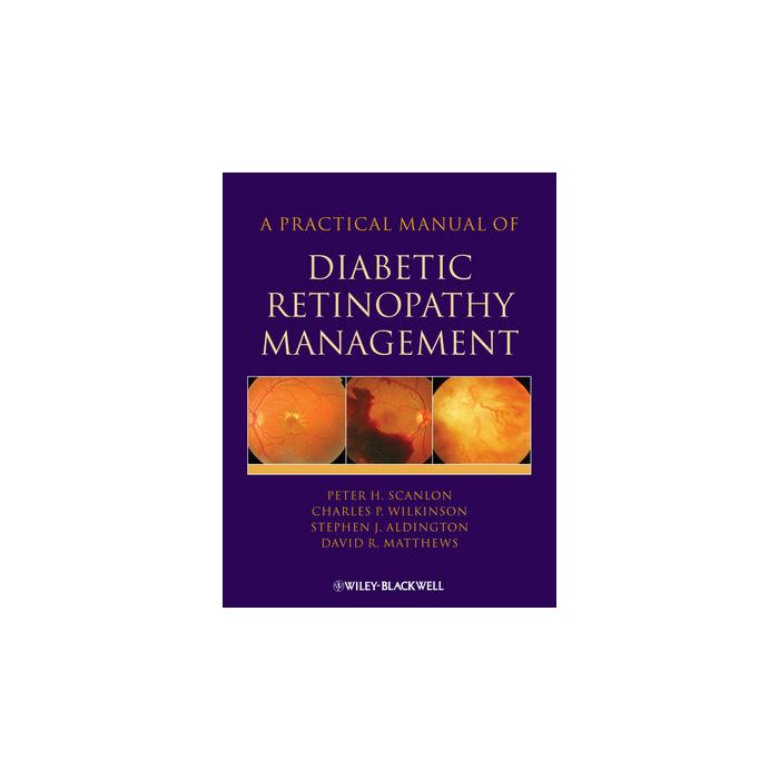 A Practical Manual of Diabetic Retinopathy Management Scanlon Peter; Aldington Stephen; Wilkinson Charles; Matthews David Wiley - Blackwell 9781405170352 A Practical Manual of Diabetic Retinopathy Management Scanlon Peter; Aldington Stephen; Wilkinson Charles; Matthews David Wiley - Blackwell 9781405170352