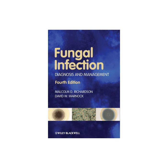 Fungal Infection: Diagnosis and Management, 4ed. Richardson Malcolm D.; Warnock David W. Wiley - Blackwell 9781405170567 Fungal Infection: Diagnosis and Management, 4ed. Richardson Malcolm D.; Warnock David W. Wiley - Blackwell 9781405170567