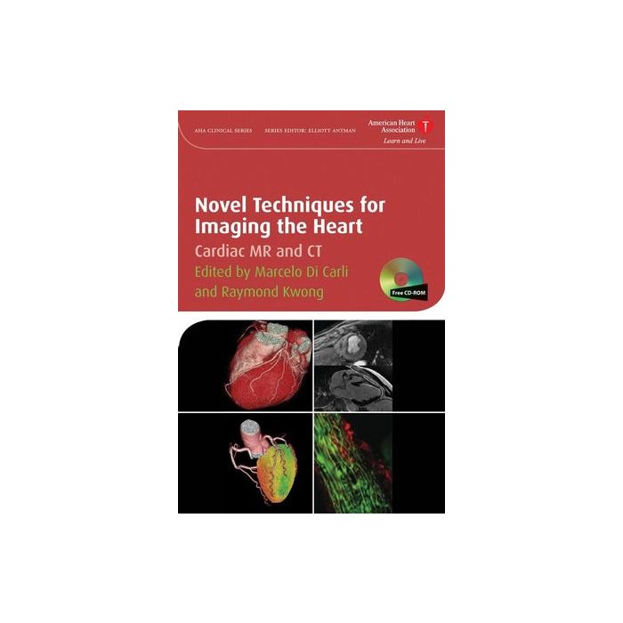Novel Techniques for Imaging the Heart: Cardiac MR and CT Di Carli Marcelo F.; Kwong Raymond Y. Wiley - Blackwell 9781405175333 Novel Techniques for Imaging the Heart: Cardiac MR and CT Di Carli Marcelo F.; Kwong Raymond Y. Wiley - Blackwell 9781405175333