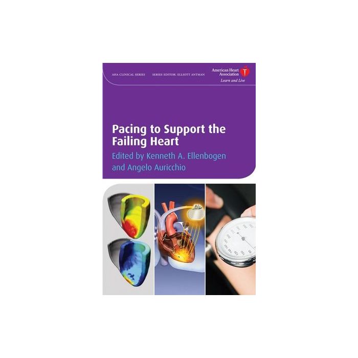 Pacing to Support the Failing Heart Ellenbogen Kenneth A.; Auricchio Angelo Wiley - Blackwell 9781405175340 Pacing to Support the Failing Heart Ellenbogen Kenneth A.; Auricchio Angelo Wiley - Blackwell 9781405175340