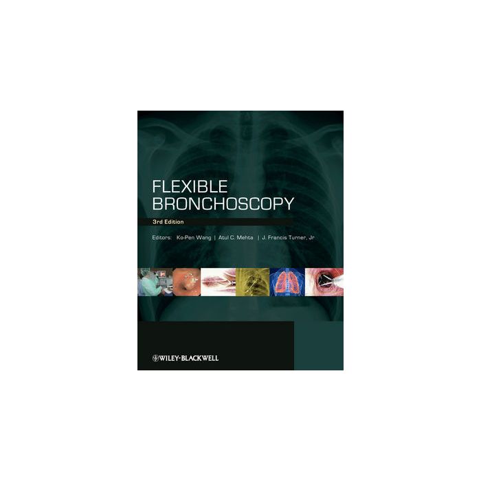 Flexible Bronchoscopy, 3ed.  Wang Ko-Pen; Mehta Atul C.; Turner J. Francis  Wiley - Blackwell  9781405175876