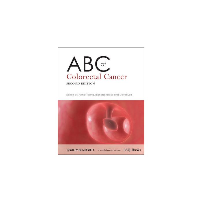 ABC of Colorectal Cancer, 2ed. Young Annie; Hobbs Richard; Kerr David Wiley - Blackwell 9781405177634 ABC of Colorectal Cancer, 2ed. Young Annie; Hobbs Richard; Kerr David Wiley - Blackwell 9781405177634