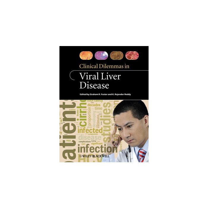 Clinical Dilemmas in Viral Liver Disease  Foster Graham; Reddy K. Rajender  Wiley - Blackwell  9781405179058