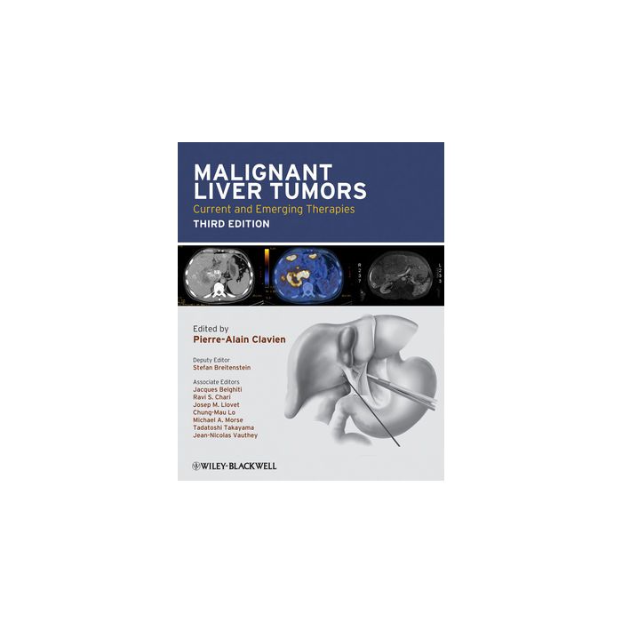 Malignant Liver Tumors: Current and Emerging Therapies, 3ed.  AA.VV.  Wiley - Blackwell  9781405179768