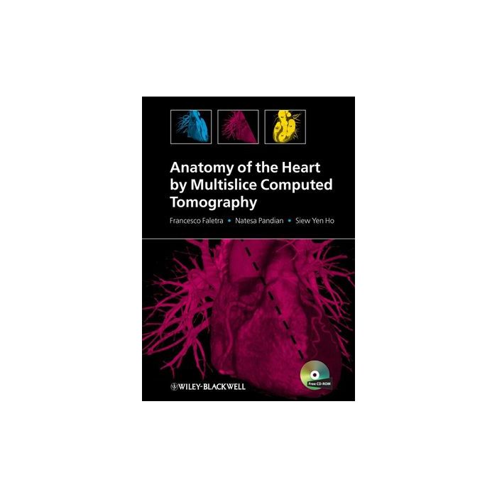 Anatomy of the Heart by Multislice Computed Tomography  Faletra Francesco; Pandian Natesa; Ho Siew Yen  Wiley - Blackwell  9781405180559 Anatomy of the Heart by Multislice Computed Tomography  Faletra Francesco; Pandian Natesa; Ho Siew Yen  Wiley - Blackwell  9781405180559
