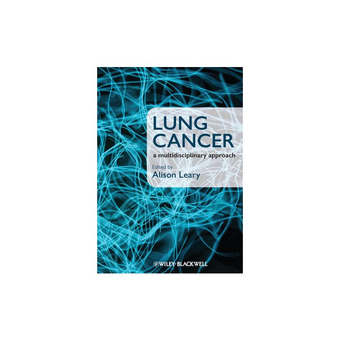 Lung Cancer: A Multidisciplinary Approach  Leary Alison  Wiley - Blackwell  9781405180757