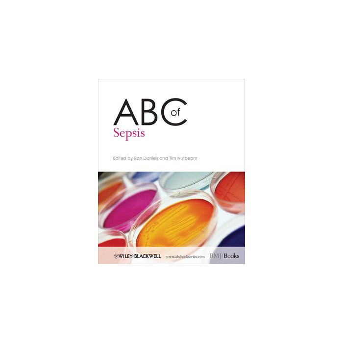 ABC of Sepsis Daniels Ron; Nutbeam Tim Wiley - Blackwell 9781405181945 ABC of Sepsis Daniels Ron; Nutbeam Tim Wiley - Blackwell 9781405181945