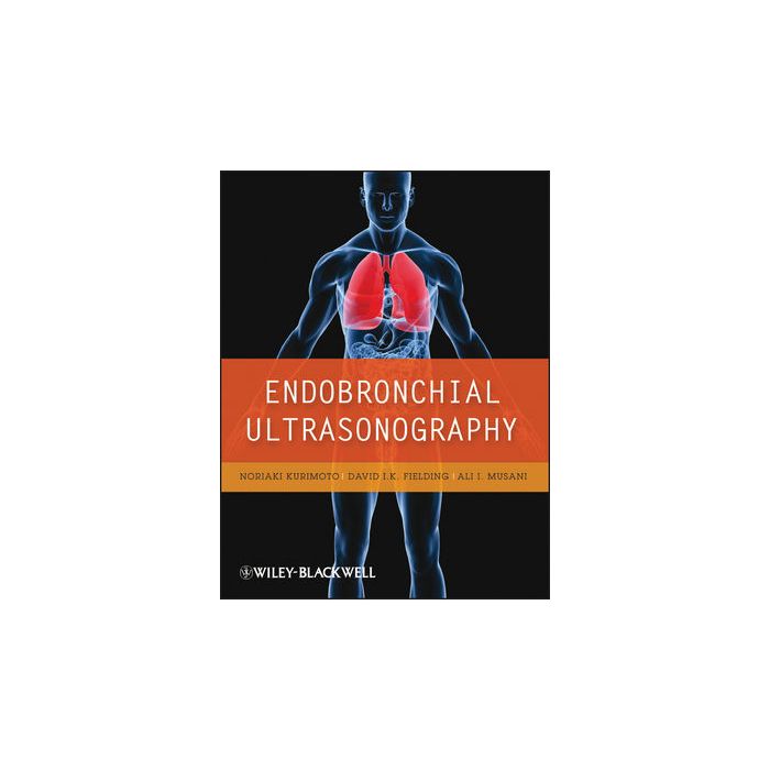 Endobronchial Ultrasonography Kurimoto Noriaki; Fielding David; Musani Ali Wiley - Blackwell 9781405182720 Endobronchial Ultrasonography Kurimoto Noriaki; Fielding David; Musani Ali Wiley - Blackwell 9781405182720
