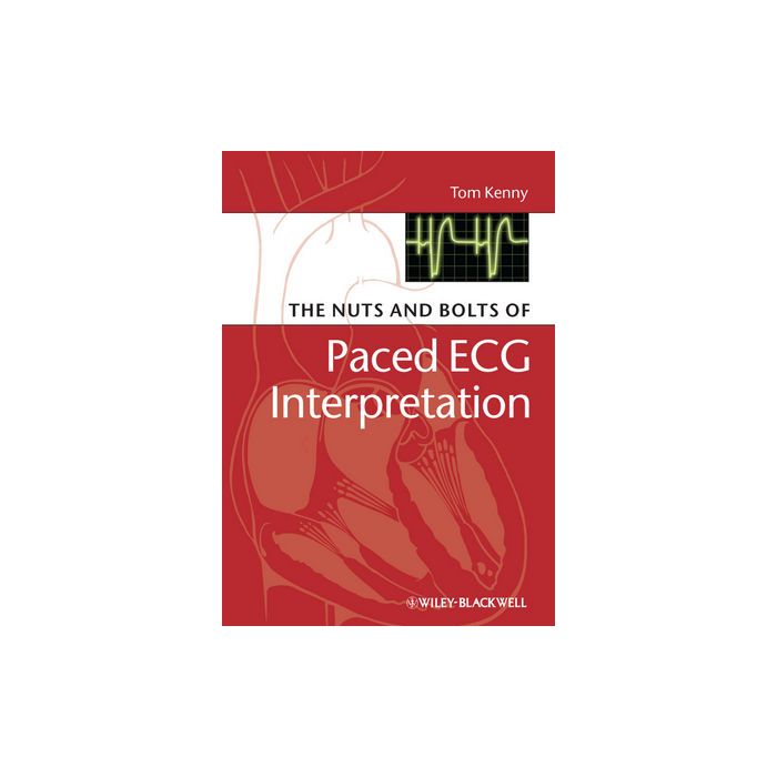 The Nuts and bolts of Paced ECG Interpretation  Kenny Tom  Wiley - Blackwell  9781405184045