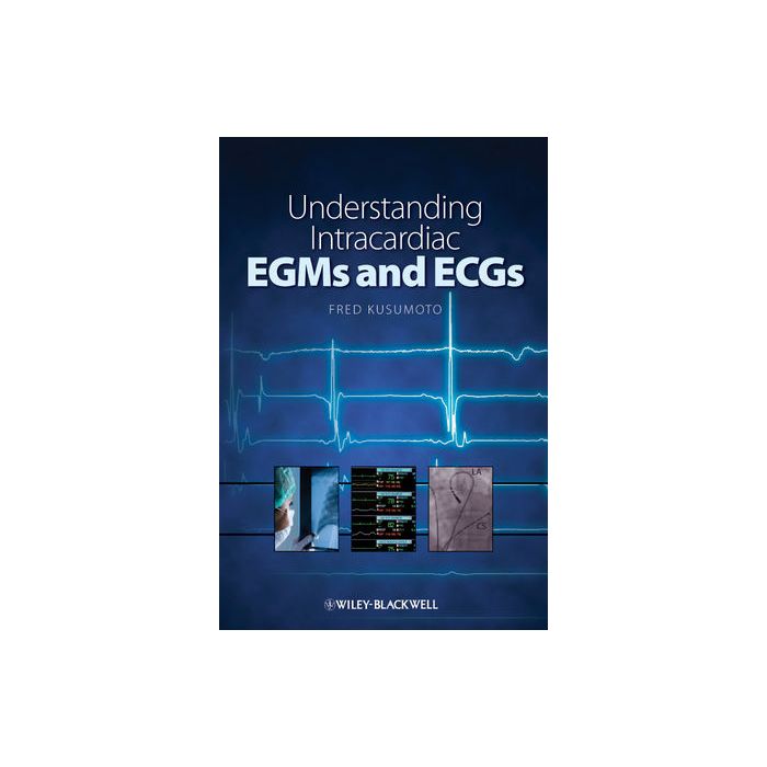 Understanding Intracardiac EGMs and ECGs  Kusumoto Fred  Wiley - Blackwell  9781405184106