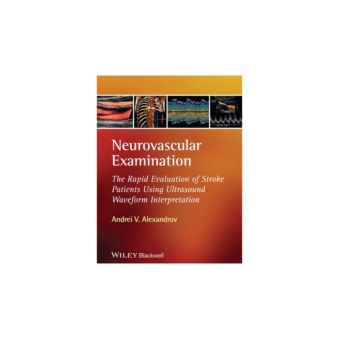 Neurovascular Examination: The Rapid Evaluation of Stroke Patients Using Ultrasound Waveform Interpretation Alexandrov Andrei V. Wiley-Blackwell 9781405185301 Neurovascular Examination: The Rapid Evaluation of Stroke Patients Using Ultrasound Waveform Interpretation Alexandrov Andrei V. Wiley-Blackwell 9781405185301