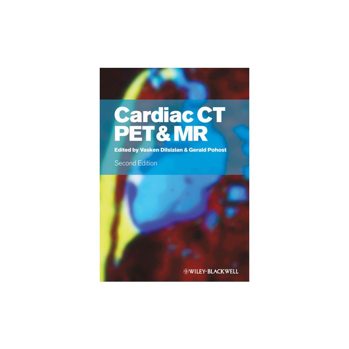 Cardiac CT, PET and MR, 2ed. Dilsizian Vasken; Pohost Gerald M. Wiley - Blackwell 9781405185530 Cardiac CT, PET and MR, 2ed. Dilsizian Vasken; Pohost Gerald M. Wiley - Blackwell 9781405185530