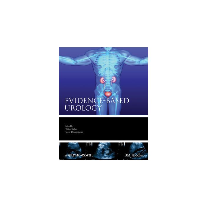 Evidence-based Urology Dahm Philipp; Dmochowski Roger Wiley - Blackwell 9781405185943 Evidence-based Urology Dahm Philipp; Dmochowski Roger Wiley - Blackwell 9781405185943