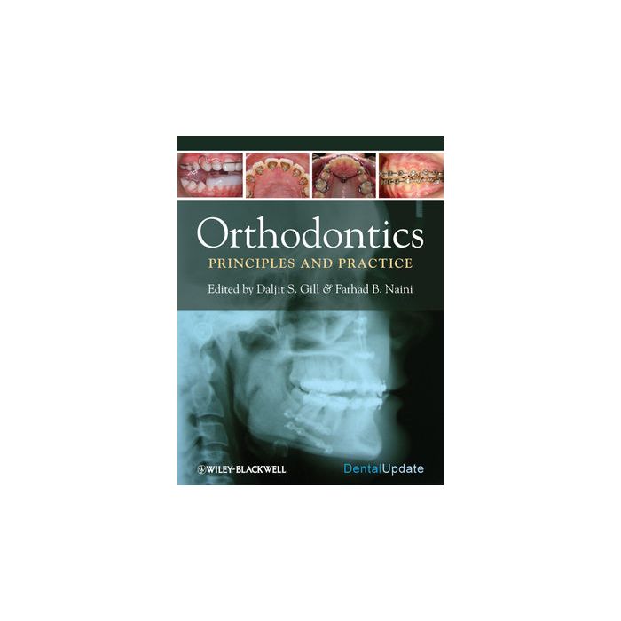 Orthodontics: Principles and Practice  Gill Daljit; Naini Farhad B.  Wiley - Blackwell  9781405187473