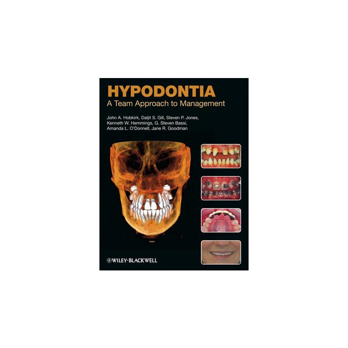 Hypodontia: A Team Approach to Management  Hobkirk John A.; Gill Daljit; Jones Steven P.; Hemmings Kenneth W.  Wiley - Blackwell  9781405188593
