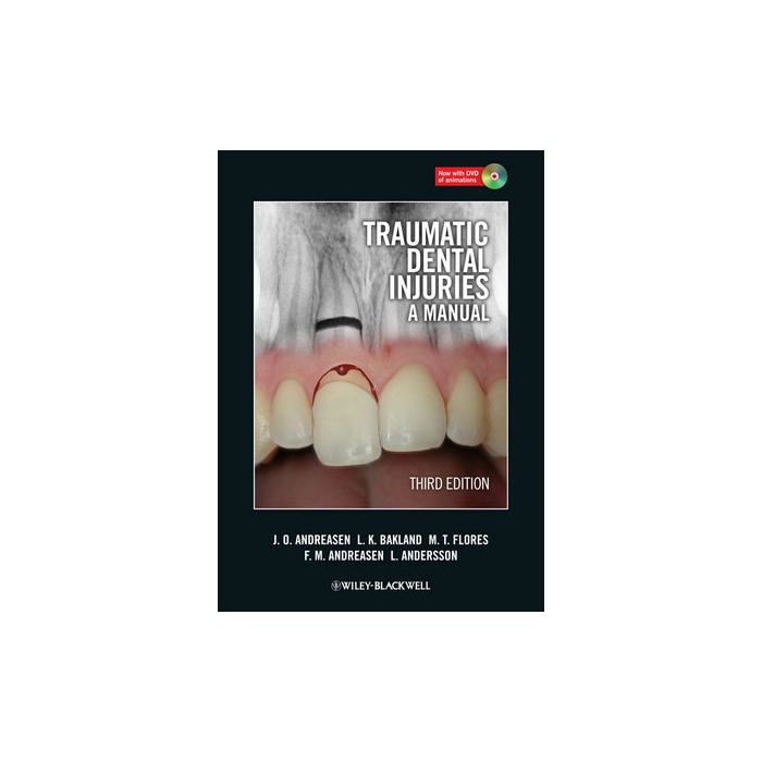 Traumatic Dental Injuries: A Manual, 3ed. Andreasen Jens O.; Bakland Leif K.; Flores Maria Teresa; Andreasen Frances M.; Andersson Lars Wiley - Blackwell 9781405190619 Traumatic Dental Injuries: A Manual, 3ed. Andreasen Jens O.; Bakland Leif K.; Flores Maria Teresa; Andreasen Frances M.; Andersson Lars Wiley - Blackwell 9781405190619