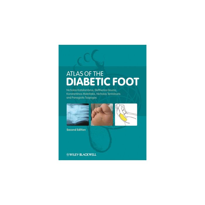 Atlas of the Diabetic Foot, 2ed. Katsilambros Nicholas; Dounis Eleftherios; Makrilakis Konstantinos; Tentolouris Nikolaos; Tsapogas Panagiotis Wiley - Blackwell 9781405191791 Atlas of the Diabetic Foot, 2ed. Katsilambros Nicholas; Dounis Eleftherios; Makrilakis Konstantinos; Tentolouris Nikolaos; Tsapogas Panagiotis Wiley - Blackwell 9781405191791