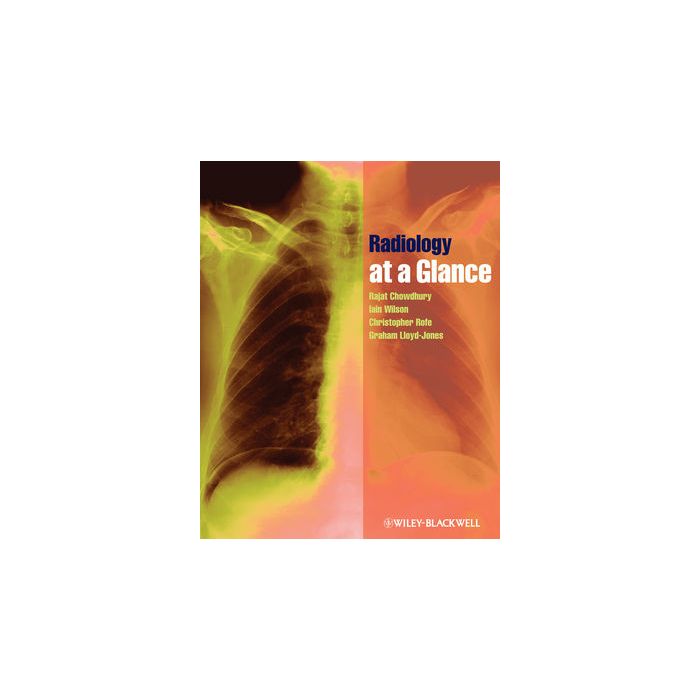 Radiology at a Glance  Chowdhury Rajat; Wilson Iain; Rofe Christopher; Lloyd-Jones Graham  Wiley - Blackwell  9781405192200