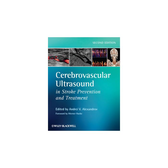 Cerebrovascular Ultrasound in Stroke Prevention and Treatment, 2ed.  Alexandrov Andrei V.; Hacke Werner  Wiley - Blackwell  9781405195768 Cerebrovascular Ultrasound in Stroke Prevention and Treatment, 2ed.  Alexandrov Andrei V.; Hacke Werner  Wiley - Blackwell  9781405195768