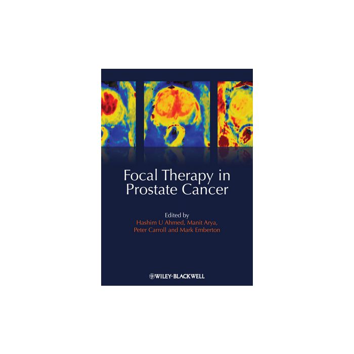 Focal Therapy in Prostate Cancer Ahmed Hashim Uddin; Arya Manit; Carroll Peter R.; Emberton Mark Wiley - Blackwell 9781405196499 Focal Therapy in Prostate Cancer Ahmed Hashim Uddin; Arya Manit; Carroll Peter R.; Emberton Mark Wiley - Blackwell 9781405196499