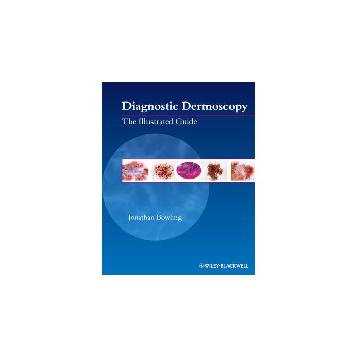 Diagnostic Dermoscopy: The Illustrated Guide  Bowling Jonathan  Wiley - Blackwell  9781405198554