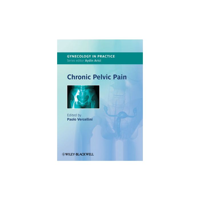 Chronic Pelvic Pain Vercellini Paolo Wiley - Blackwell 9781444330663 Chronic Pelvic Pain Vercellini Paolo Wiley - Blackwell 9781444330663