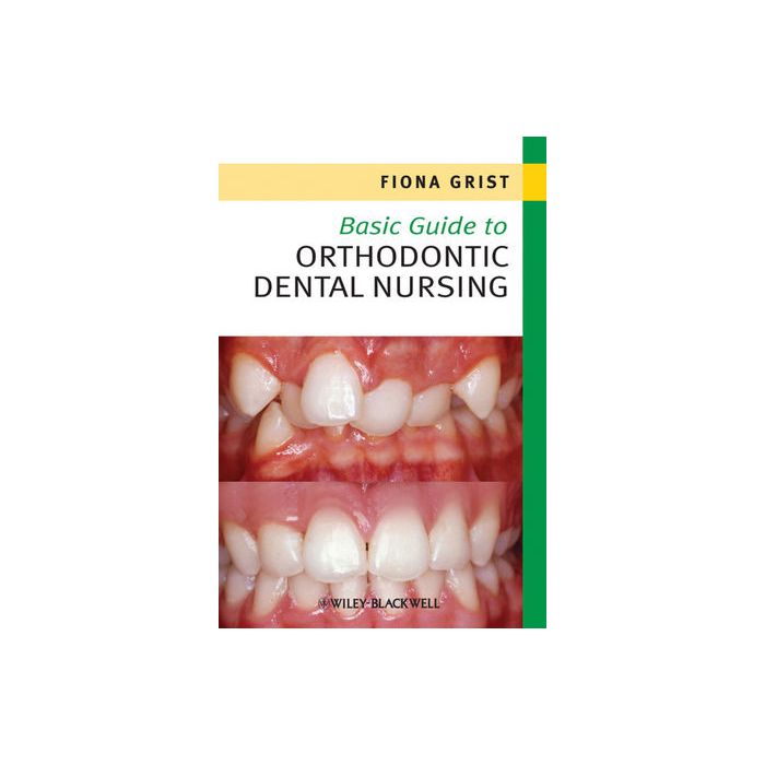 Basic Guide to Orthodontic Dental Nursing  Grist Fiona  Wiley - Blackwell  9781444333183