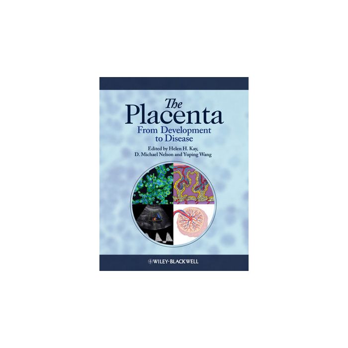 The Placenta: From Development to Disease Kay Helen; Nelson D. Michael; Wang Yuping Wiley - Blackwell 9781444333664 The Placenta: From Development to Disease Kay Helen; Nelson D. Michael; Wang Yuping Wiley - Blackwell 9781444333664