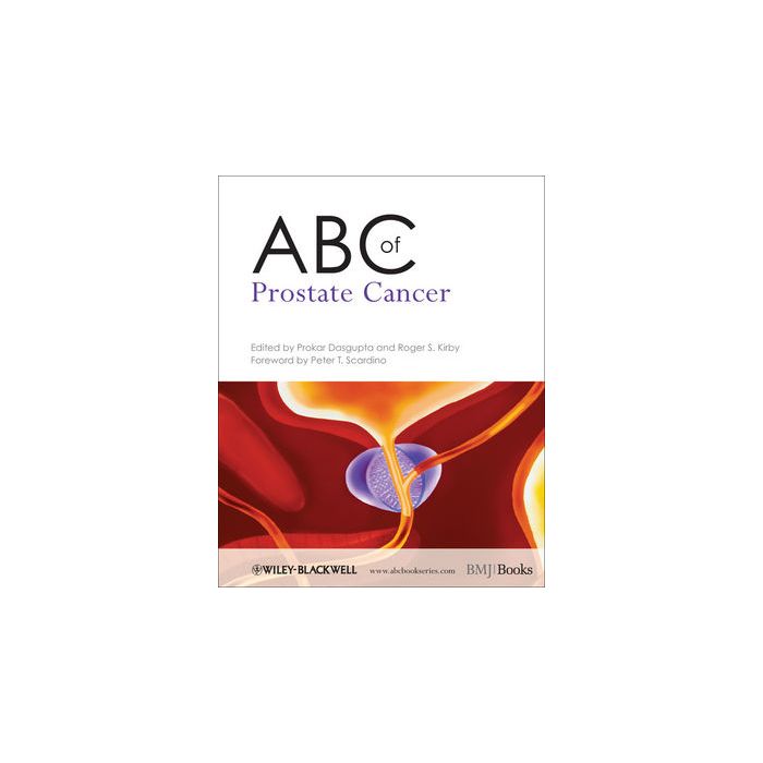 ABC of Prostate Cancer  Dasgupta Prokar; Kirby Roger S.  Wiley - Blackwell  9781444334371