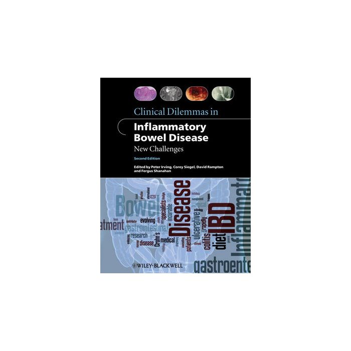 Clinical Dilemmas in Inflammatory Bowel Disease: New Challenges, 2ed.  Irving Peter; Siegel Corey A.; Rampton David; Shanahan Fergus  Wiley - Blackwell  9781444334548