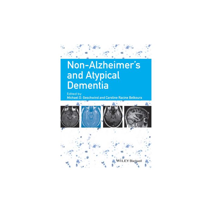 Non-Alzheimer's and Atypical Dementia Geschwind Michael D.; Racine Belkoura Caroline Wiley - Blackwell 9781444336245 Non-Alzheimer's and Atypical Dementia Geschwind Michael D.; Racine Belkoura Caroline Wiley - Blackwell 9781444336245