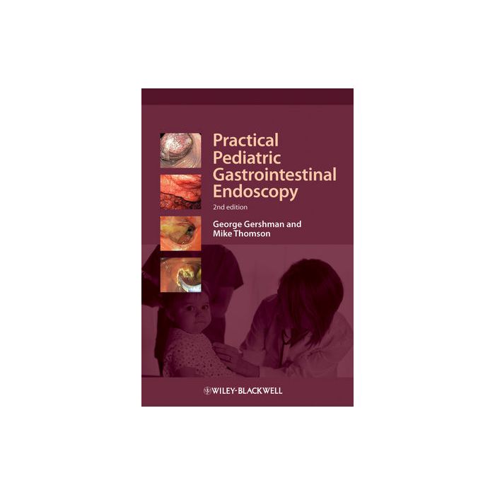 Practical Pediatric Gastrointestinal Endoscopy, 2ed. Gershman George; Thomson Mike Wiley - Blackwell 9781444336498 Practical Pediatric Gastrointestinal Endoscopy, 2ed. Gershman George; Thomson Mike Wiley - Blackwell 9781444336498