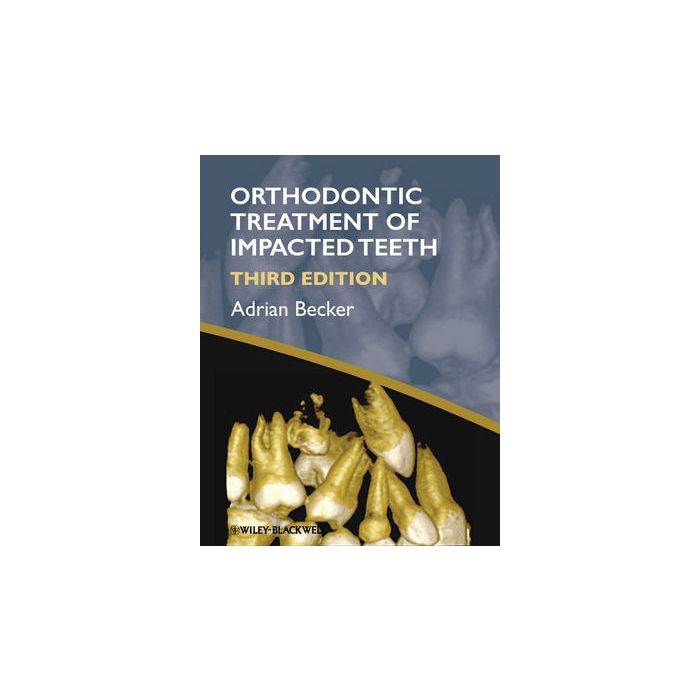 Orthodontic Treatment of Impacted Teeth, 3ed.  Becker Adrian  Wiley - Blackwell  9781444336757