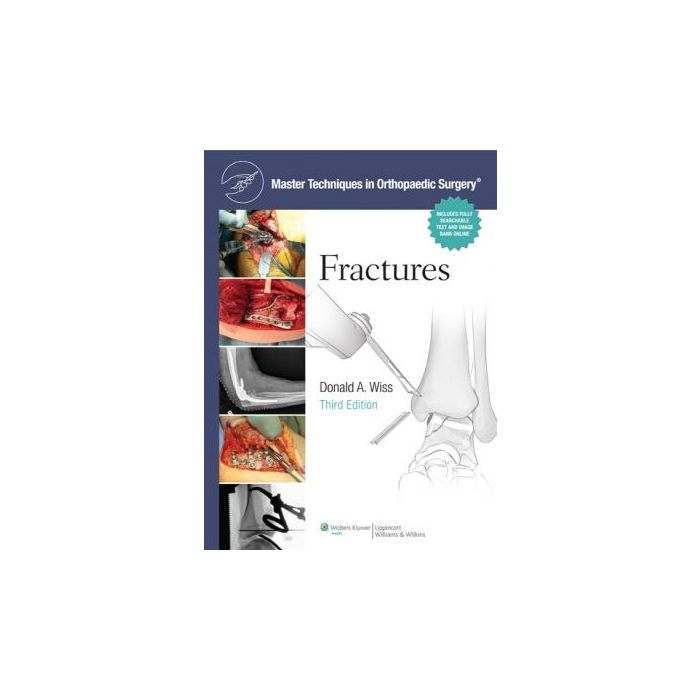 Master Techniques in Orthopaedic Surgery: Fractures, 3ed.  Wiss Donald  LIPPINCOTT Williams and Wilkins  9781451108149