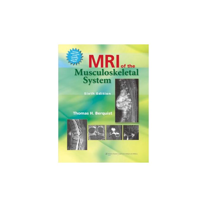 MRI of the Musculoskeletal System, 6ed. Berquist Thomas H. LIPPINCOTT Williams and Wilkins 9781451109184 MRI of the Musculoskeletal System, 6ed. Berquist Thomas H. LIPPINCOTT Williams and Wilkins 9781451109184