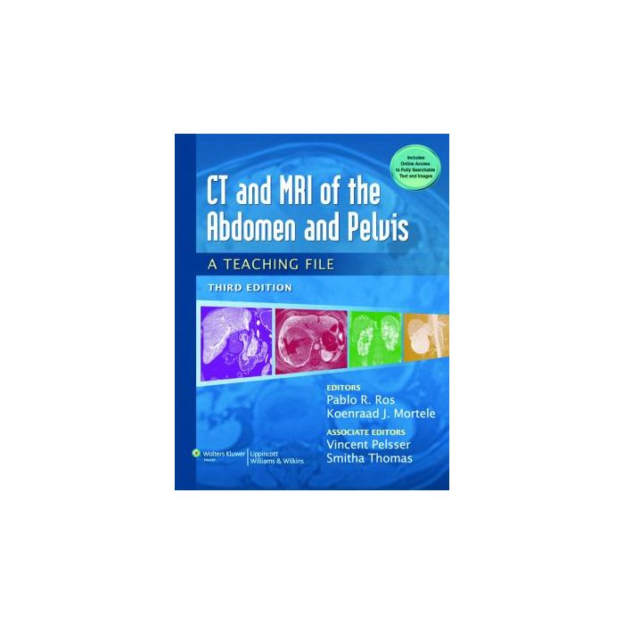 CT & MRI of the Abdomen and Pelvis, 3ed.  Ros Pablo R.; Mortele Koenraad J.  LIPPINCOTT Williams and Wilkins  9781451113525 CT & MRI of the Abdomen and Pelvis, 3ed.  Ros Pablo R.; Mortele Koenraad J.  LIPPINCOTT Williams and Wilkins  9781451113525