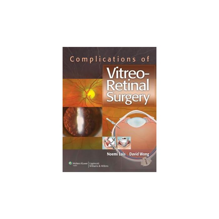 Complications of Vitreo-Retinal Surgery  Lois Noemi; Wong David  LIPPINCOTT Williams and Wilkins  9781451119381 Complications of Vitreo-Retinal Surgery  Lois Noemi; Wong David  LIPPINCOTT Williams and Wilkins  9781451119381