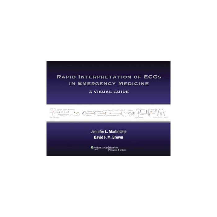 Rapid Interpretation of ECGs in Emergency Medicine Martindale Jennifer L.; Brown David F.M. LIPPINCOTT Williams and Wilkins 9781451128376 Rapid Interpretation of ECGs in Emergency Medicine Martindale Jennifer L.; Brown David F.M. LIPPINCOTT Williams and Wilkins 9781451128376