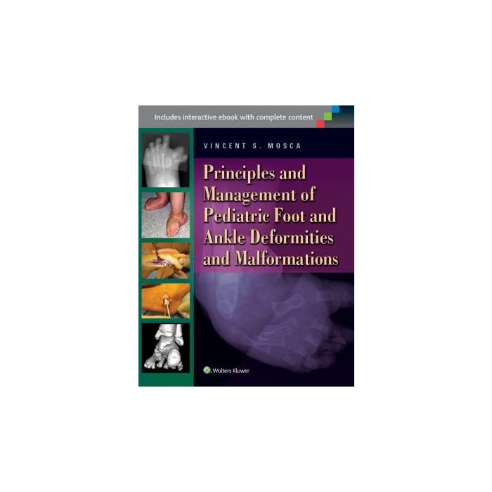 Principles and Management of Pediatric Foot and Ankle Deformities and Malformations Mosca Vincent S. LIPPINCOTT Williams and Wilkins 9781451130454 Principles and Management of Pediatric Foot and Ankle Deformities and Malformations Mosca Vincent S. LIPPINCOTT Williams and Wilkins 9781451130454
