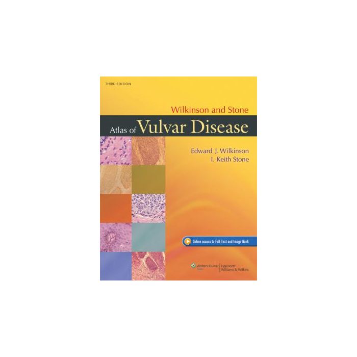 Wilkinson and Stone Atlas of Vulvar Disease, 3ed. Wilkinson Edward J. LIPPINCOTT Williams and Wilkins 9781451132182 Wilkinson and Stone Atlas of Vulvar Disease, 3ed. Wilkinson Edward J. LIPPINCOTT Williams and Wilkins 9781451132182