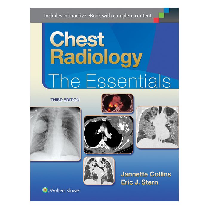 Chest Radiology, 3ed. The Essentials - Collins Janette; Stern Eric J. - LIPPINCOTT Williams and Wilkins - 9781451144482 Chest Radiology, 3ed. The Essentials - Collins Janette; Stern Eric J. - LIPPINCOTT Williams and Wilkins - 9781451144482