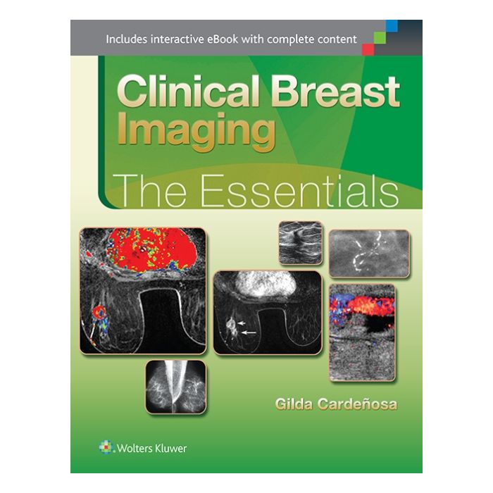 Clinical Breast Imaging. The Essentials - Cardenosa Gilda - LIPPINCOTT Williams and Wilkins - 9781451151770 Clinical Breast Imaging. The Essentials - Cardenosa Gilda - LIPPINCOTT Williams and Wilkins - 9781451151770