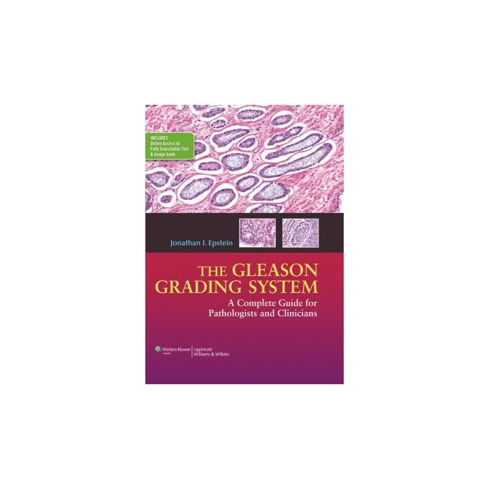 The Gleason Grading System: A Complete Guide for Pathologists and Clinicians  Epstein Jonathan I.  LIPPINCOTT Williams and Wilkins  9781451172829