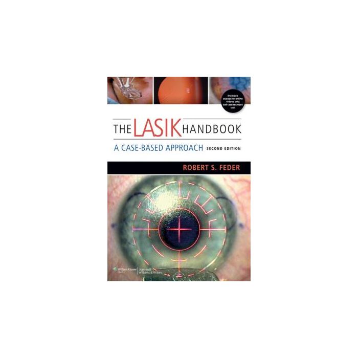 The LASIK Handbook, 2ed. Feder Robert S. LIPPINCOTT Williams and Wilkins 9781451172843 The LASIK Handbook, 2ed. Feder Robert S. LIPPINCOTT Williams and Wilkins 9781451172843